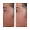 Murad Rapid Dark Spot Correcting Serum Mini 5 Ml - Image 3
