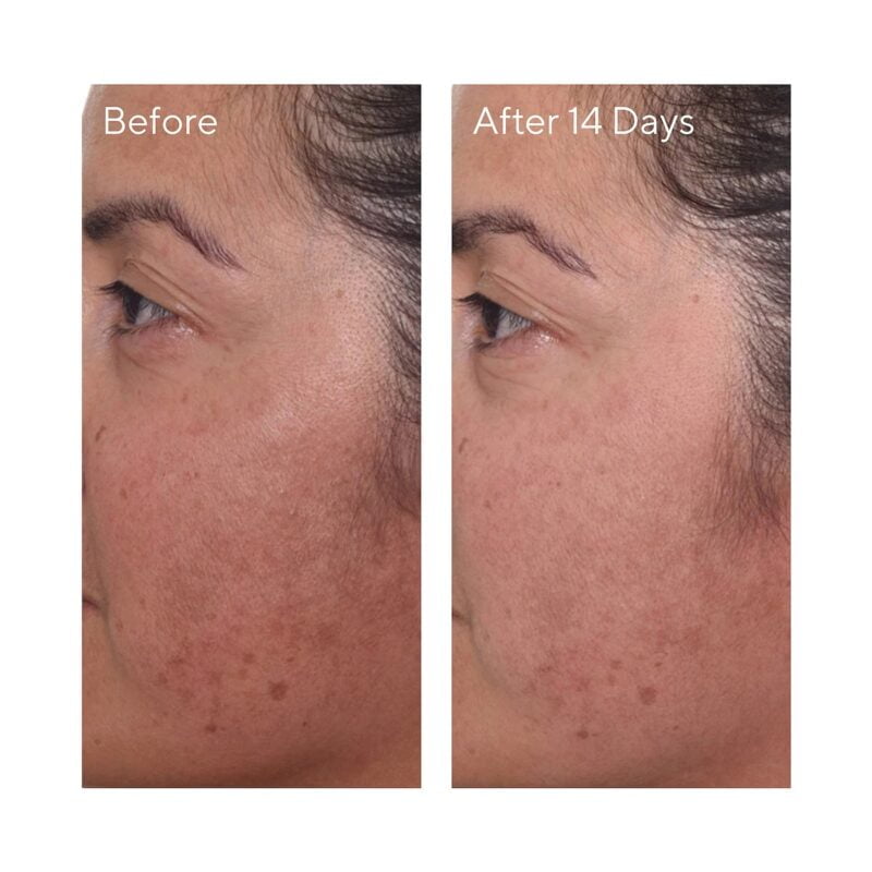 Murad Rapid Dark Spot Correcting Serum Mini 5 Ml - Image 3