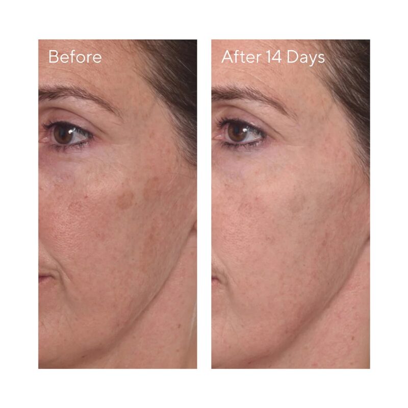 Murad Rapid Dark Spot Correcting Serum Mini 5 Ml - Image 4