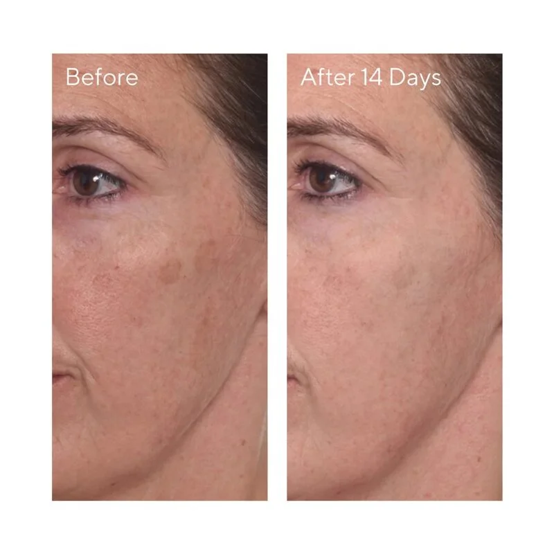 Murad Rapid Dark Spot Correcting Serum Mini 5 Ml - Image 4