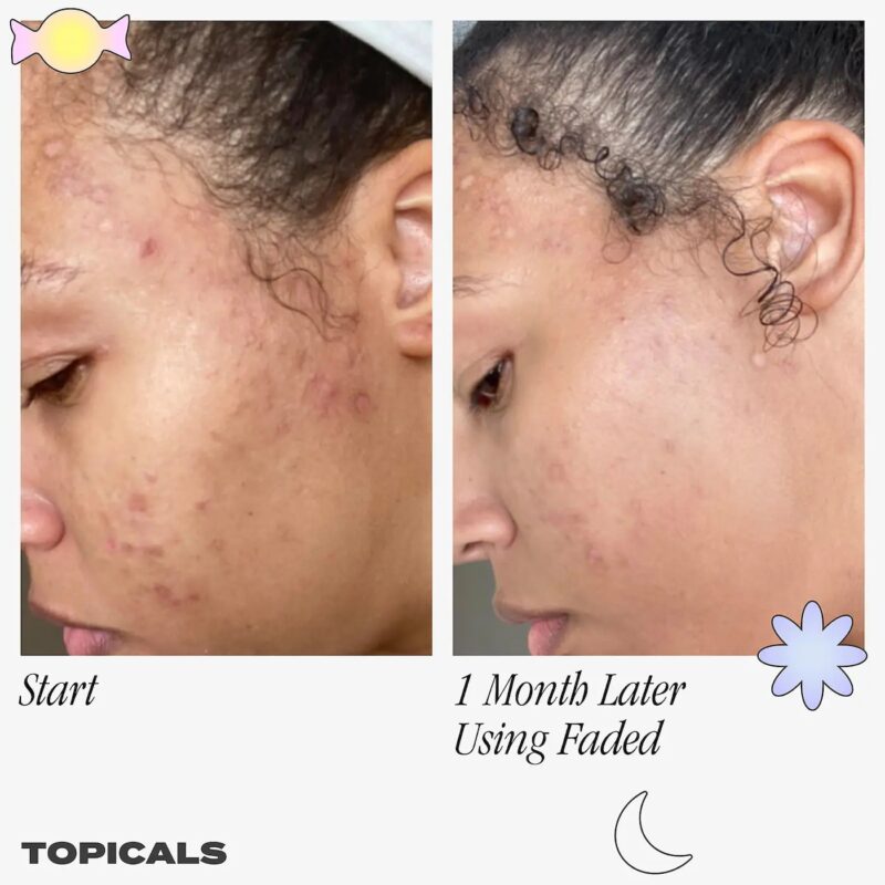 Topicals Faded Serum For Dark Spots & Discoloration - International Makeup