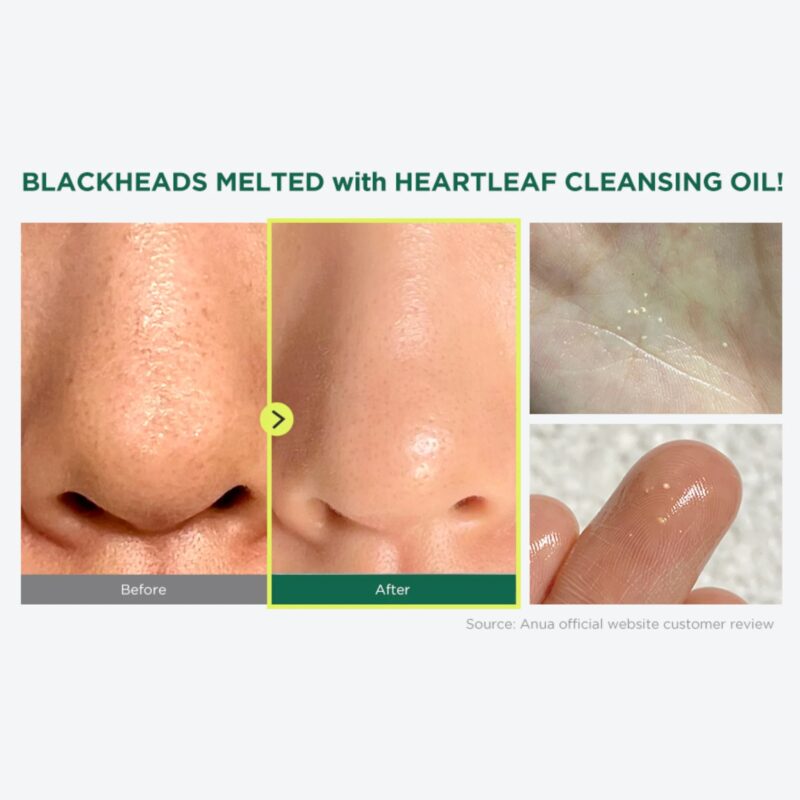 Anua Heartleaf Pore Control Cleansing Oil - Image 3
