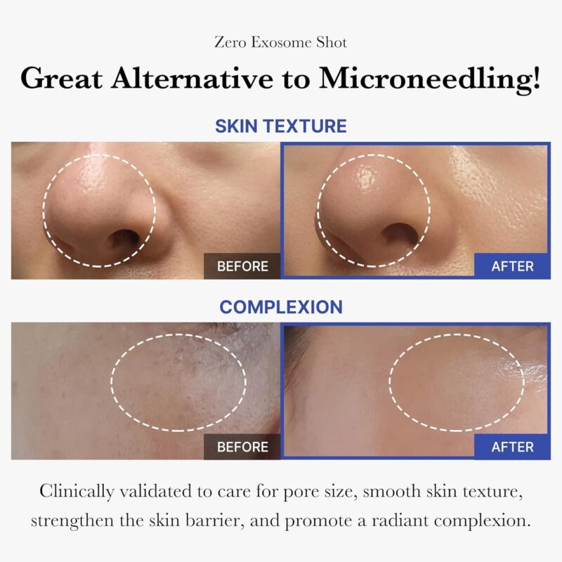 Medicube Zero Exosome Shot Spicule Facial Serum - Image 2
