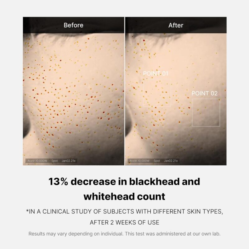 Medicube Zero Pore One-Day Serum - Image 5