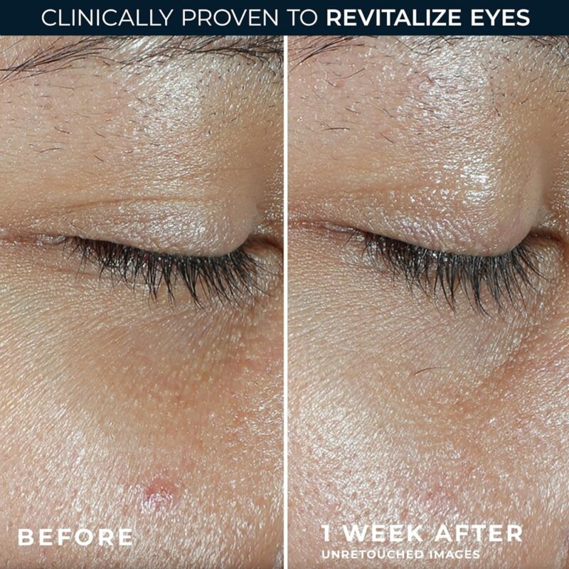 ROC Multi Correxion Revive + Glow Eye Balm - Image 4
