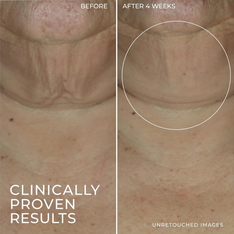 ROC Derm Correxion Retinol Firming Serum Stick - Image 6
